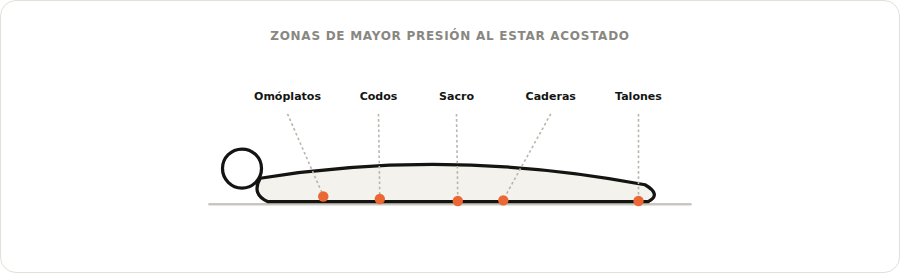 Mapa de zonas de mayor presión al estar acostado: omóplatos, codos, sacro, caderas y talones
