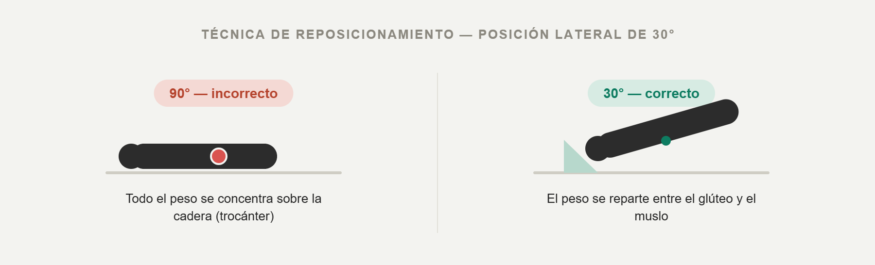 Comparación de la posición a 90 grados frente a la posición lateral de 30 grados para redistribuir la presión