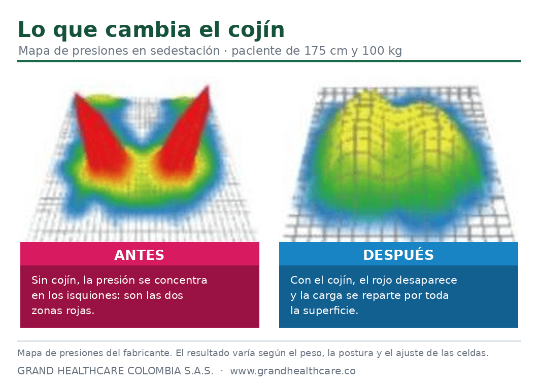 Mapa de presiones antes y después de usar el cojín Qubix